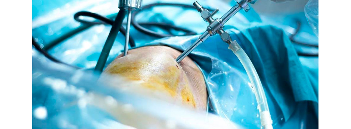 Los nuevos avances de la cirugía artroscópica - Dr. Esteban Castro - Médico Traumatólogo Ortopédista | Cirugía de columna y articular