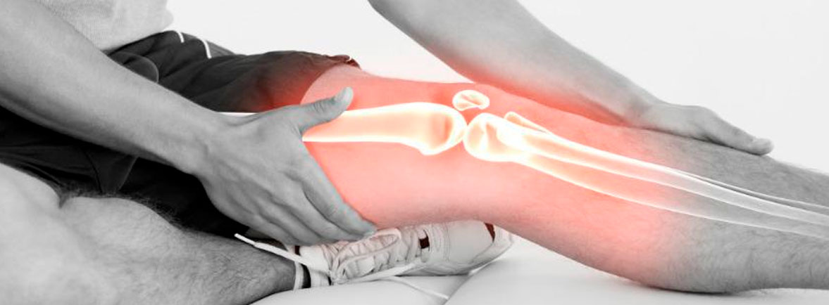 Dolor de Rodilla