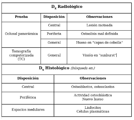 Osteomielitis esclerosante de garré - Dr. Esteban Castro - Médico Traumatólogo Ortopédista | Cirugía de columna y articular