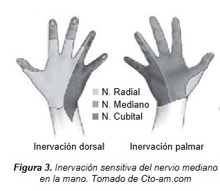 Síndrome del túnel del carpo - Dr. Esteban Castro - Médico Traumatólogo Ortopédista | Cirugía de columna y articular