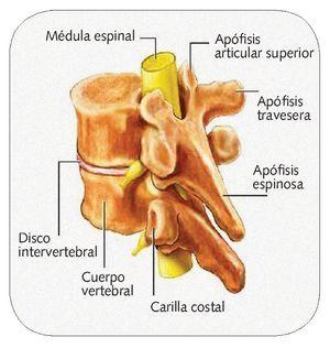 Dr. Esteban Castro - Ortopedia y traumatología Hernia de disco lumbar