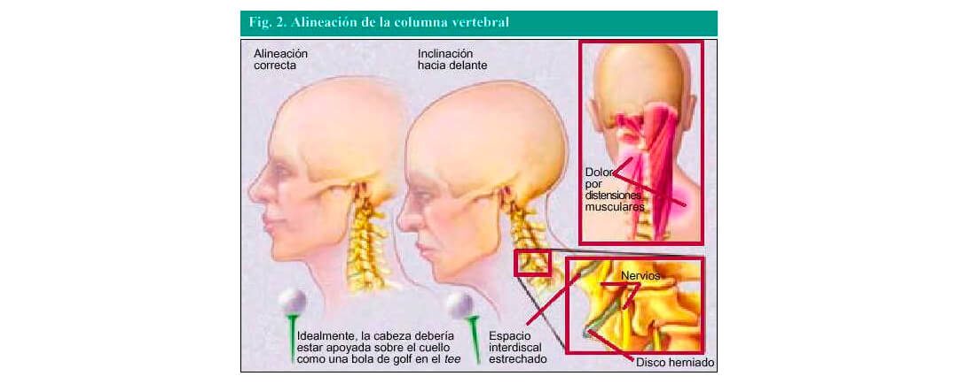 Cervicalgia - Dr. Esteban Castro - Médico Traumatólogo Ortopédista