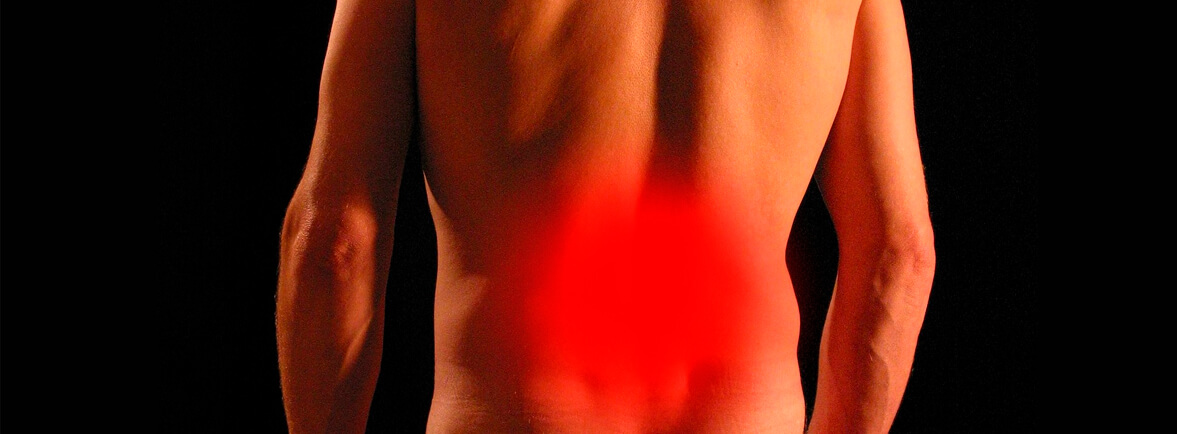 Dolor de nervio ciático