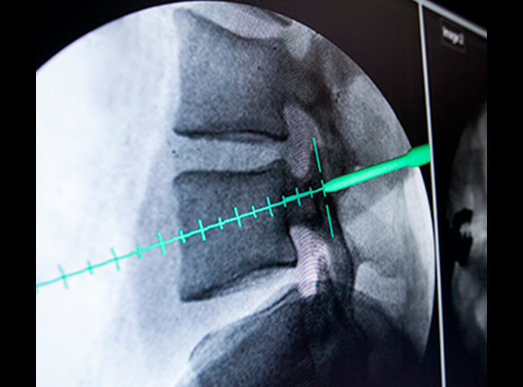 Cirugía de columna en guadalajara - Cirugía Ortopédica y Traumatología Cirugía de columna en guadalajara - Dr. Esteban Castro - Médico Traumatólogo Ortopédista | Cirugía de columna y articular