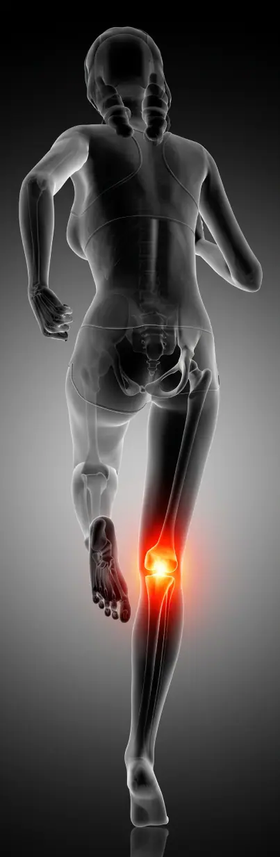 Ilustración anatómica de la rodilla con zona de dolor resaltada