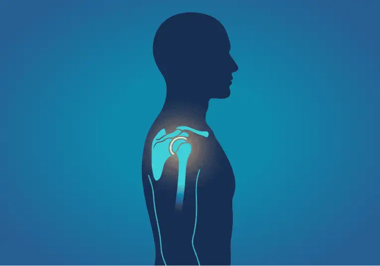 Ilustración de la articulación del hombro