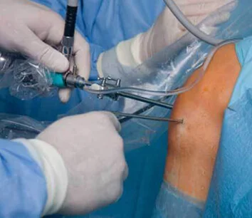 Knee surgery in guadalajara - Dr. Esteban Castro - Médico Traumatólogo Ortopédista | Cirugía de columna y articular