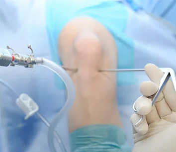 Knee surgery in guadalajara - Dr. Esteban Castro - Médico Traumatólogo Ortopédista | Cirugía de columna y articular