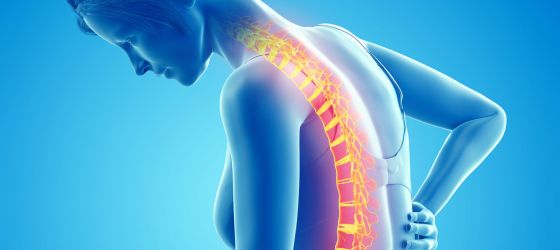 Hernia discal: síntomas, diagnóstico y tratamiento