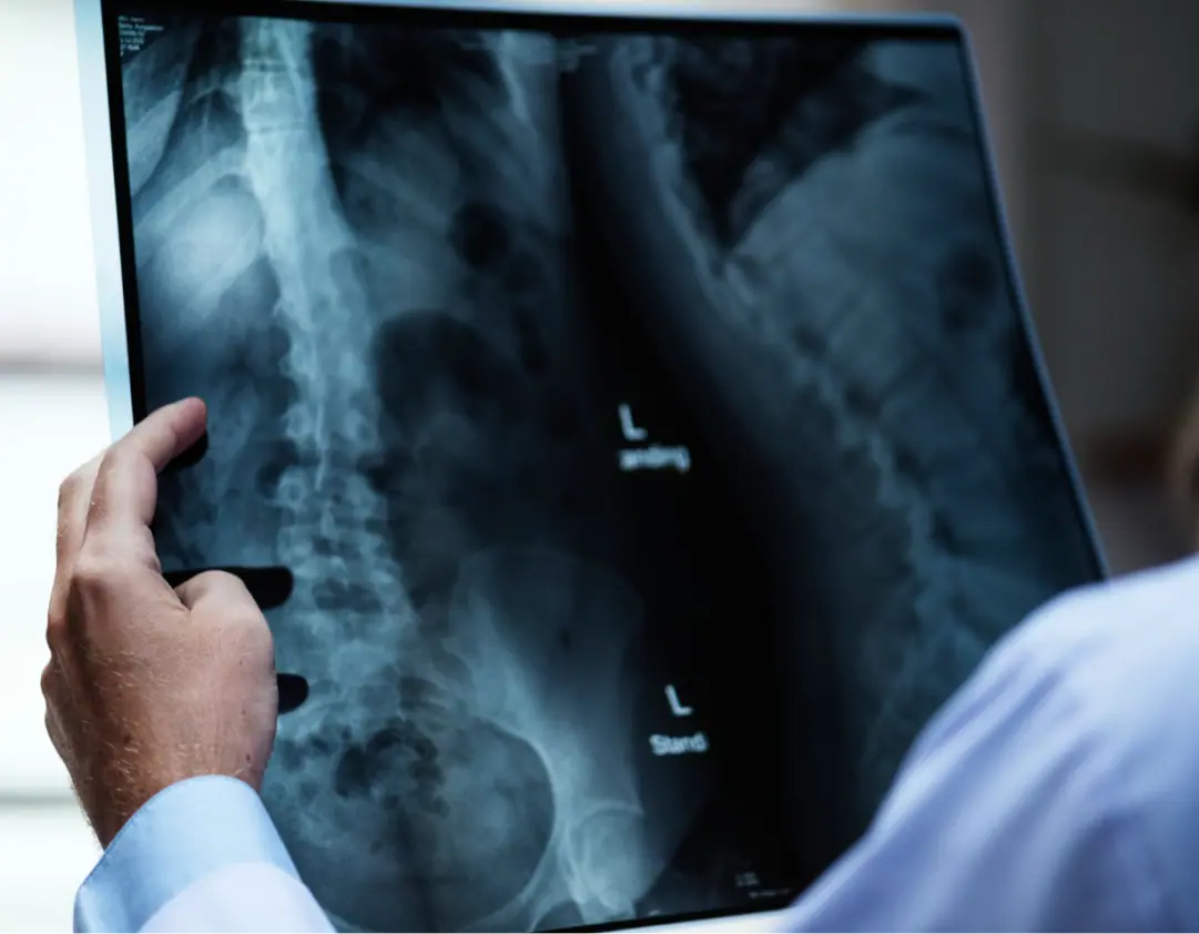 Radiografía de cadera evaluada por un especialista