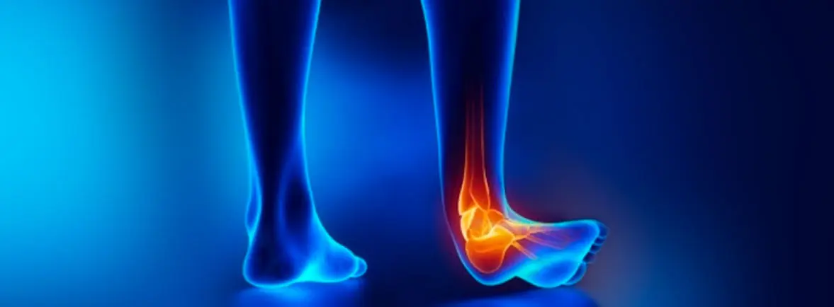 Lesion de tobillo en Zapopán - Dr. Esteban Castro - Médico Traumatólogo Ortopédista | Cirugía de columna y articular