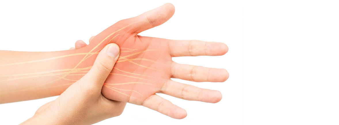 Síndrome del Túnel Carpal - Dr. Esteban Castro - Médico Traumatólogo Ortopédista | Cirugía de columna y articular