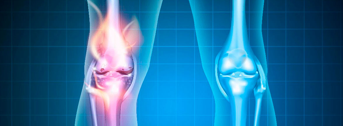Riesgos Cotidianos de las Lesiones en las Rodillas - Dr. Esteban Castro - Médico Traumatólogo Ortopédista | Cirugía de columna y articular