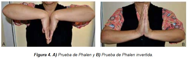 Síndrome del túnel del carpo - Dr. Esteban Castro - Médico Traumatólogo Ortopédista | Cirugía de columna y articular