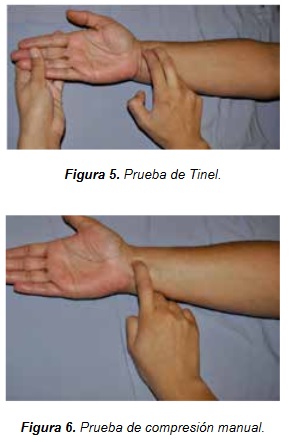 Síndrome del túnel del carpo - Dr. Esteban Castro - Médico Traumatólogo Ortopédista | Cirugía de columna y articular