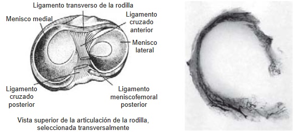 Lesión de meniscos - Las lesiones de los meniscos se producen cuando el miembro se encuentra apoyado en semiflexión y rotación del mismo. Lesión de meniscos - Dr. Esteban Castro - Médico Traumatólogo Ortopédista | Cirugía de columna y articular