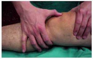 Gonartrosis - Dr. Esteban Castro - Médico Traumatólogo Ortopédista | Cirugía de columna y articular