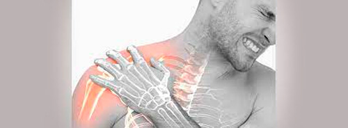 Capsulitis adhesiva, Hombro congelado
