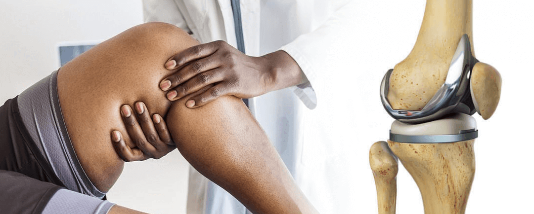 Cuanto dura una protesis de rodilla - Dr. Esteban Castro - Médico Traumatólogo Ortopédista | Cirugía de columna y articular