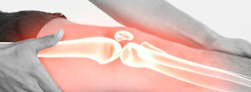 Dolor de Rodilla - Dolor de Rodilla: Cuando hay dolor, nuestro cerebro envía un mensaje para alertarnos ante alguna situación que está por suceder, lo cual requiere de nuestra atención. Generalmente el dolor es una acción evolutiva. Dolor de Rodilla