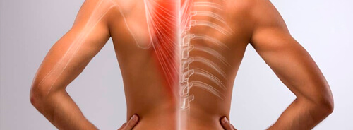 Hernia de disco cervical / Hernia de disco y Diagnóstico con Resonancia Magnética en Guadalajara