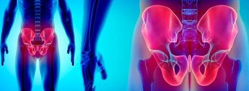 Manejo agudo de fracturas acetabulares