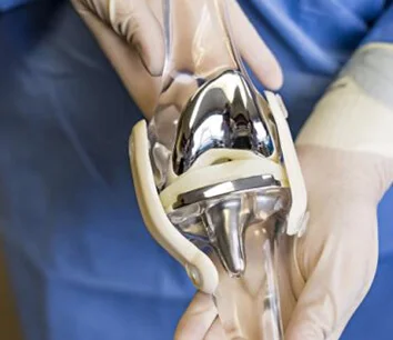 Sobrevida de rodillas protésicas - Dr. Esteban Castro - Médico Traumatólogo Ortopédista | Cirugía de columna y articular